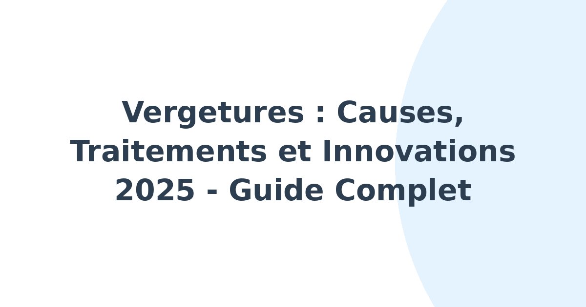 Vergetures